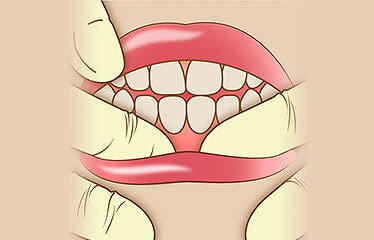 歯茎の血行を促進